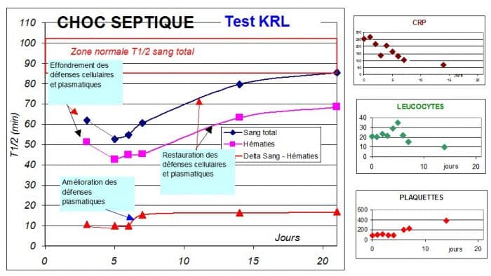 Suivi de Choc septique avec le test KRL