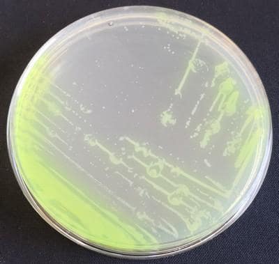 Colonies Pseudomonas aeruginosa sur milieu gélosé en boite de pétri